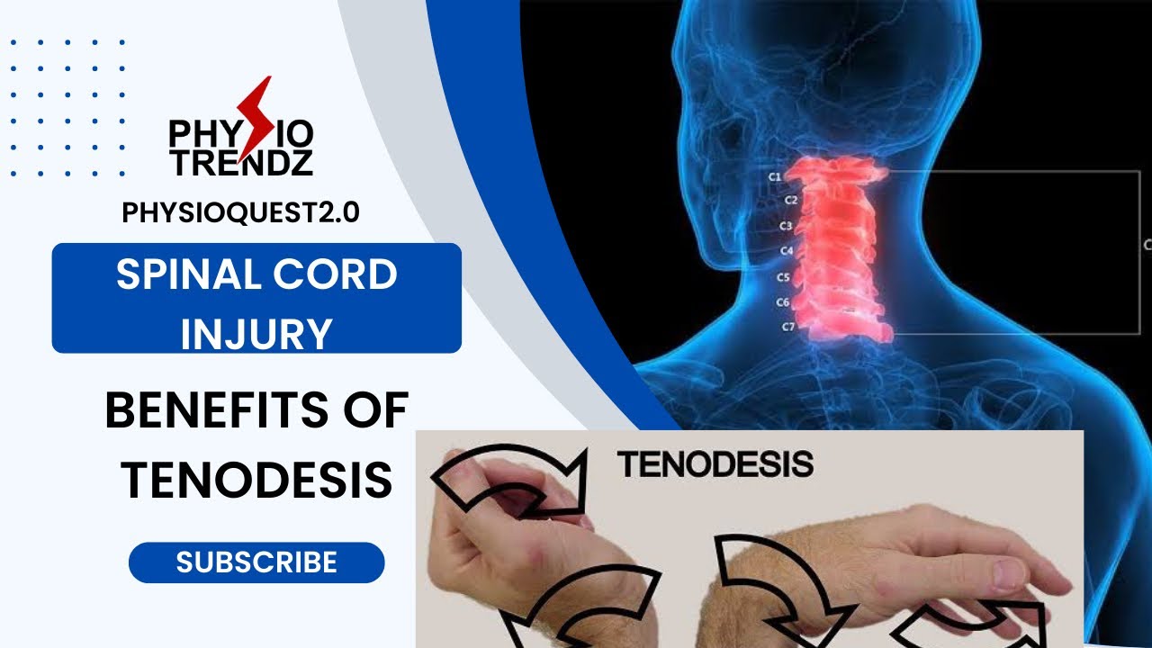 Expert Guide to C6 Spinal Cord Injury Recovery