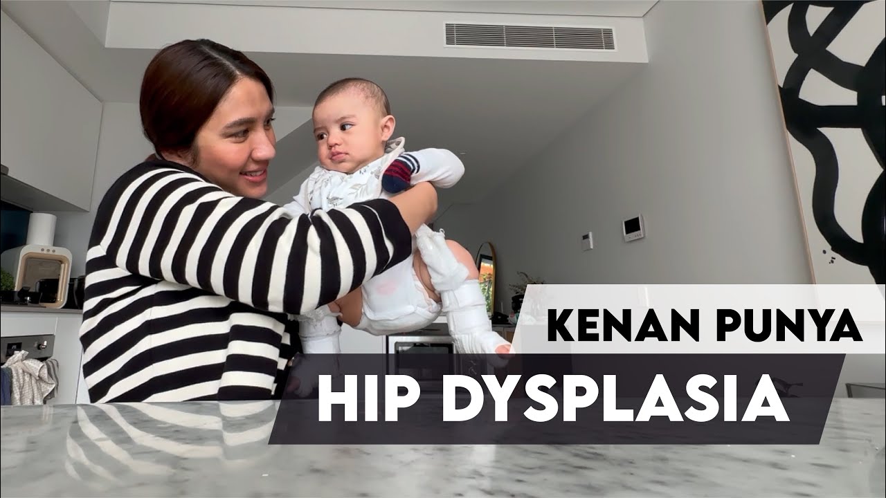 Kenan ternyata punya Hip Displasia.