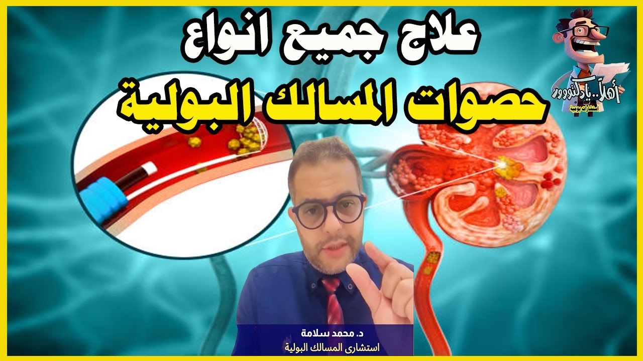 ⭐المنظار المرن لتفتيت حصوات الكلى | اهلا يا دكتور حصوات المسالك البولية تخصص المسالك البولية