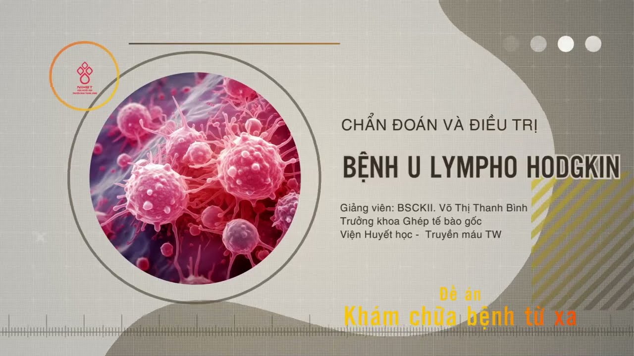 CHẨN ĐOÁN VÀ ĐIỀU TRỊ BỆNH U LYMPHO HODGKIN