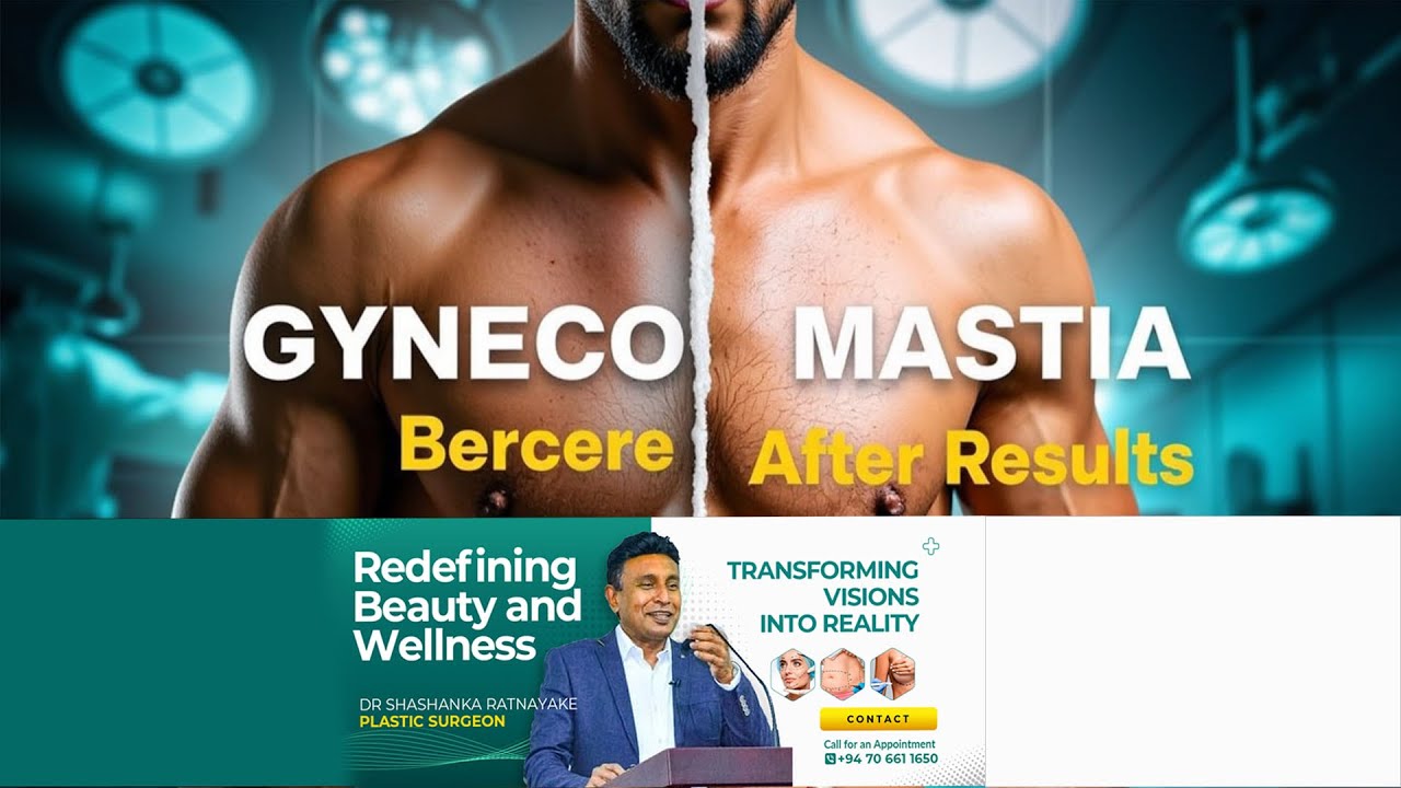 Are you struggling with gynecomastia පිරිමි පියයුරු ගැටලුවක්ද