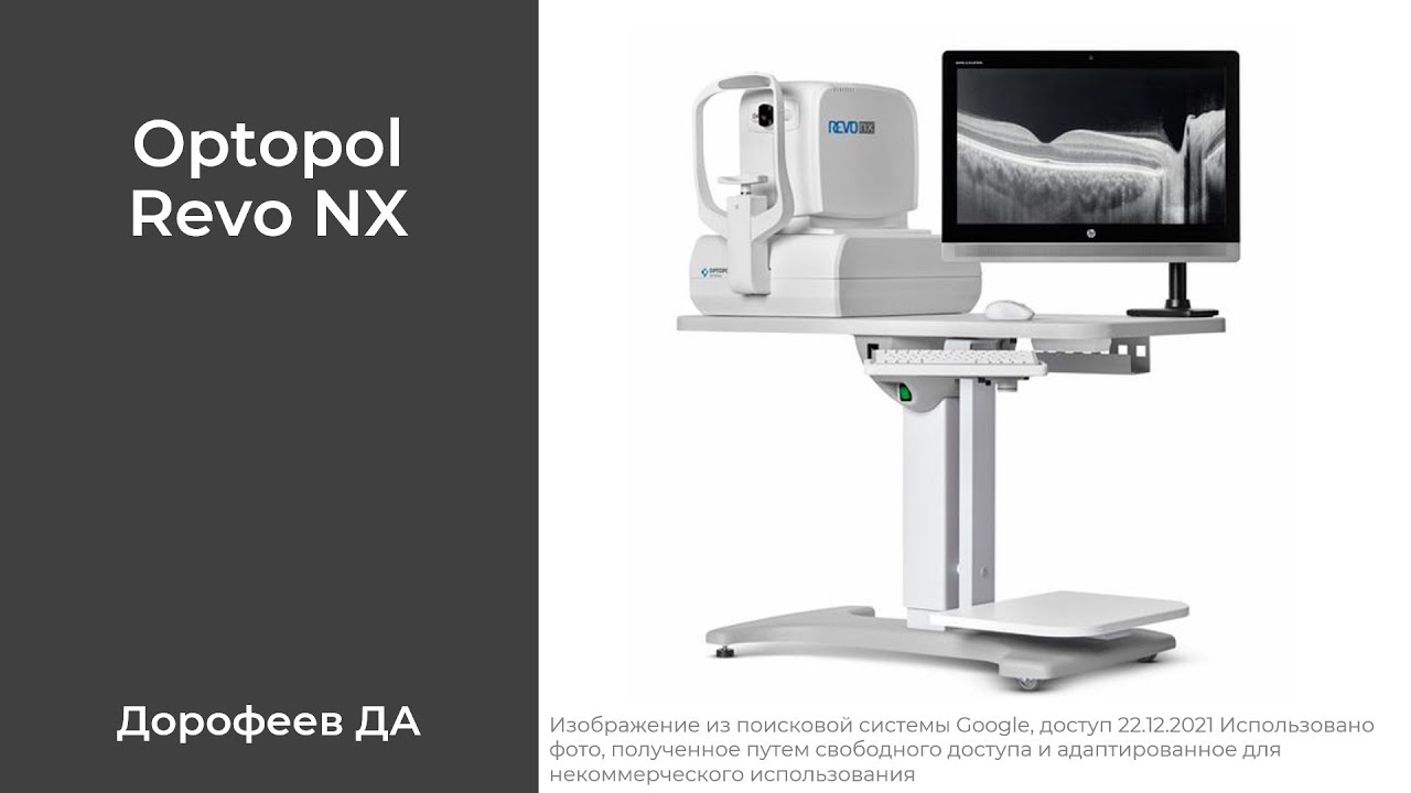 Особенности протоколов Optopol REVO NX