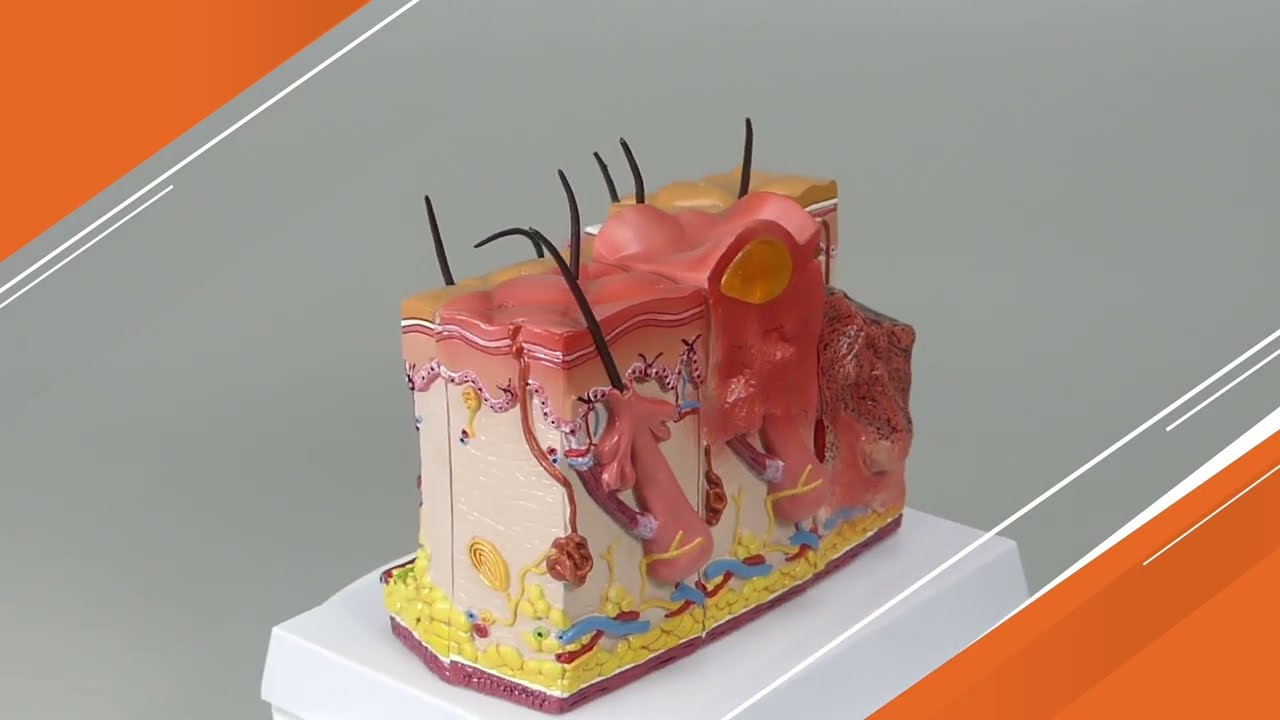 Skin Burn and Normal Skin Anatomical Model | AnatomyStuff