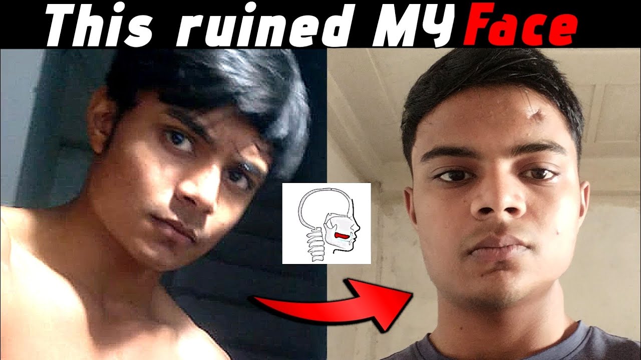 Looksmaxxing is ruining your face (Please understand this)