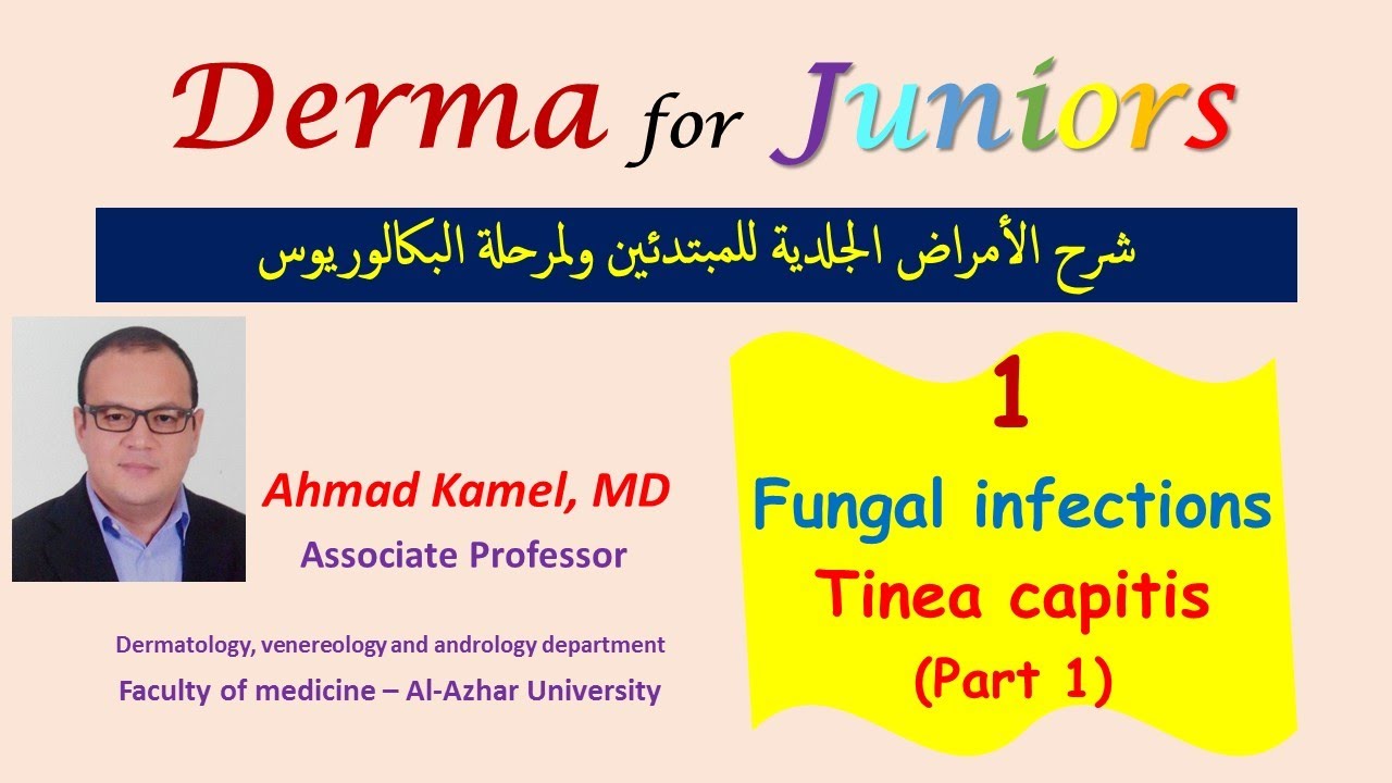 001 Fungal infections Tinea capitis 1 أمراض الجلد الفطرية