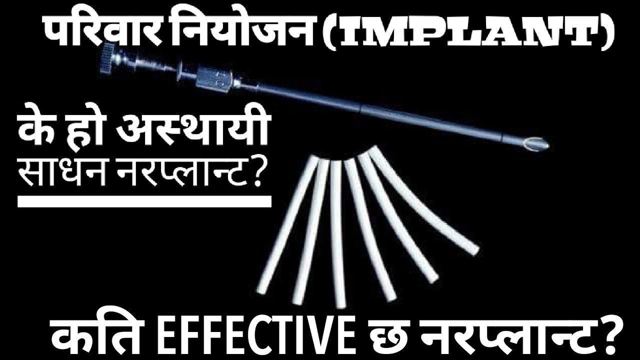 के हो अस्थायी साधन नरप्लान्ट?फाइदा र बेफाइदा केके छन?Family planning Methods norplant / implant.