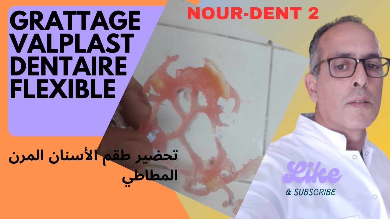 grattage valplast dentaire flexible..طقم مرن مطاطي @Nourdent