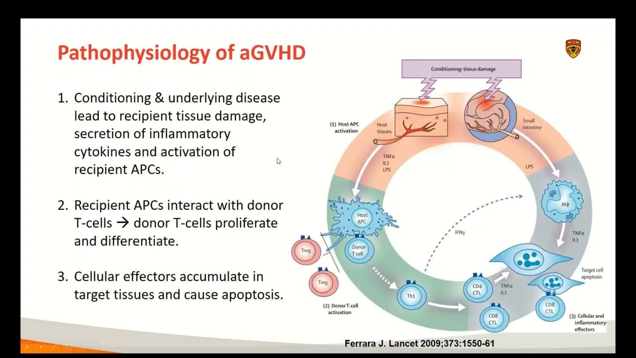 CTTC BMT101 Webinar Series: Acute GvHD - PART 2: For Trainees (Dr. Kareem Jamani)