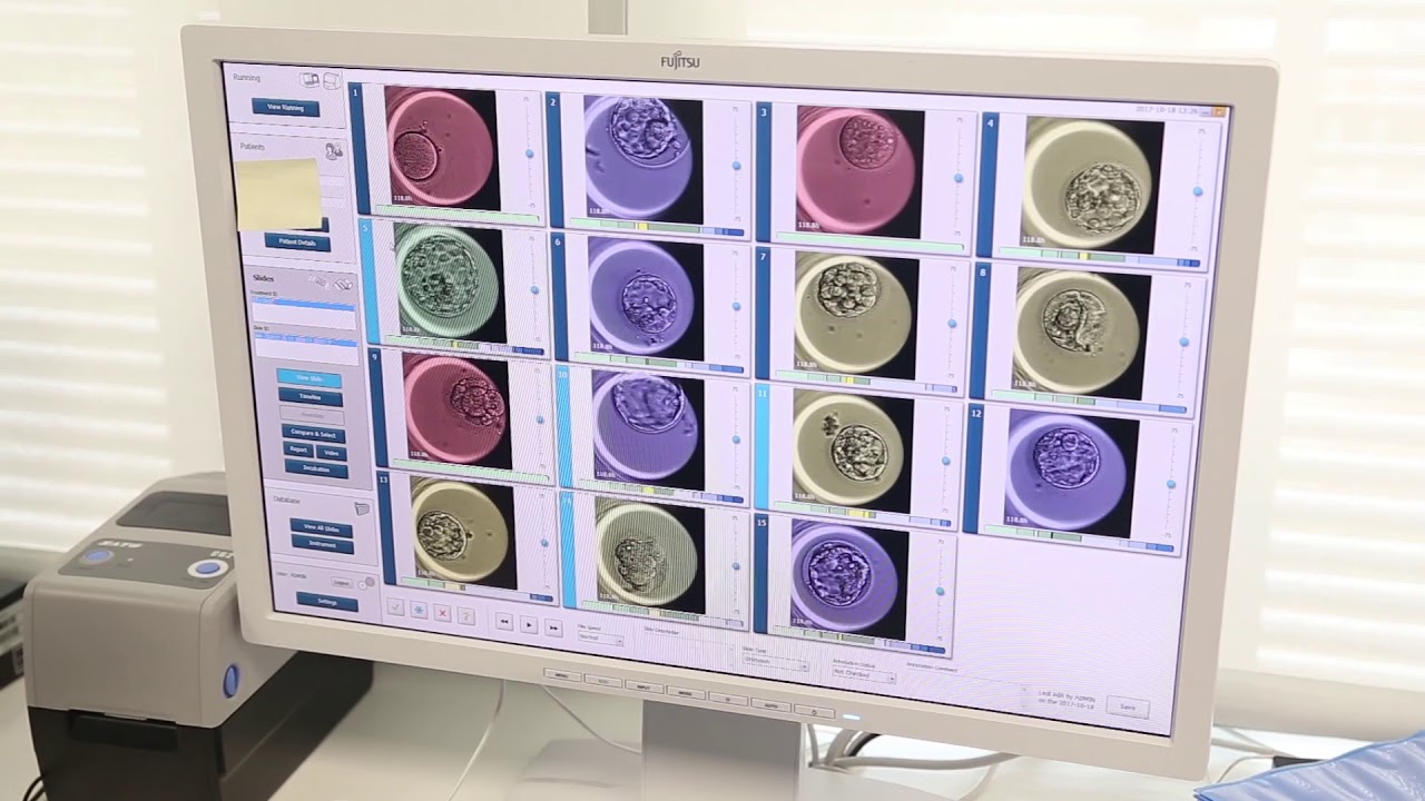 EmbryoScope - Laboratorio IVI