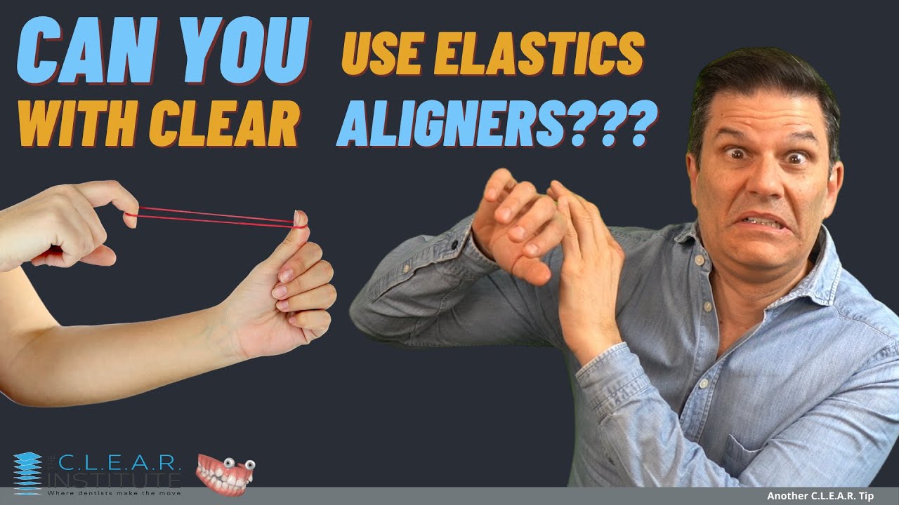 Can you use elastics with Invisalign clear aligners?