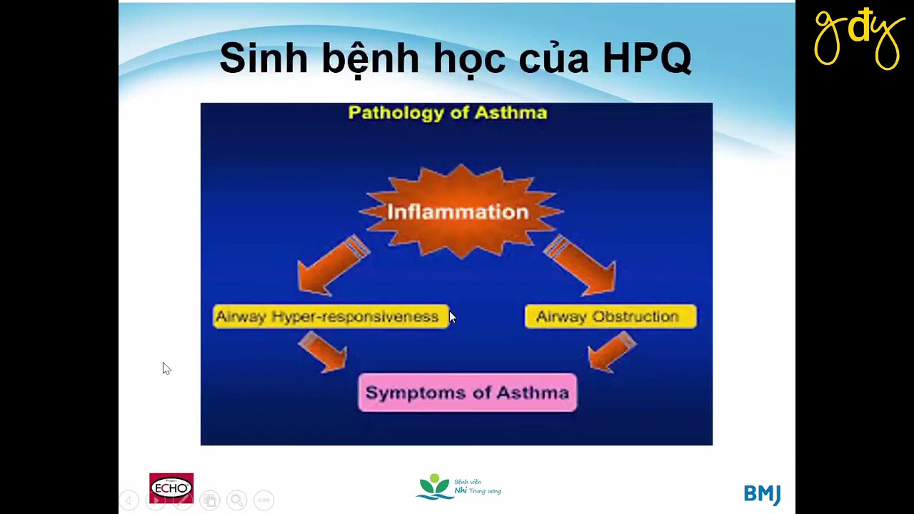 HEN PHẾ QUẢN Ở TRẺ EM | PGS. TS. Nguyễn Thị Diệu Thúy