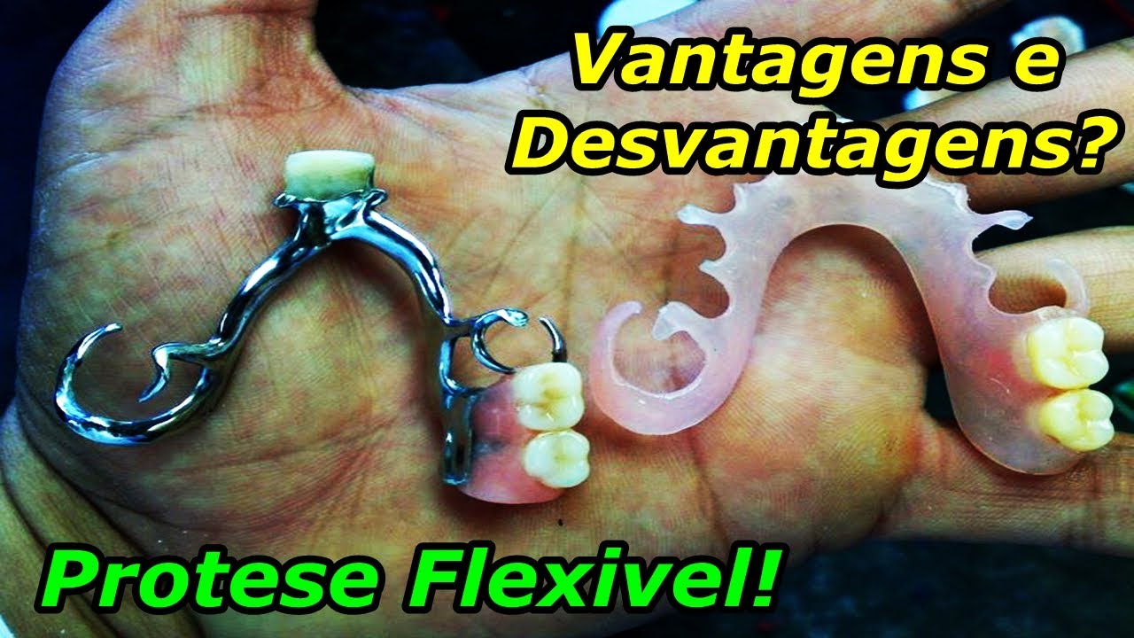Prótese Removível Flexível - Vantagens e Desvantagens.