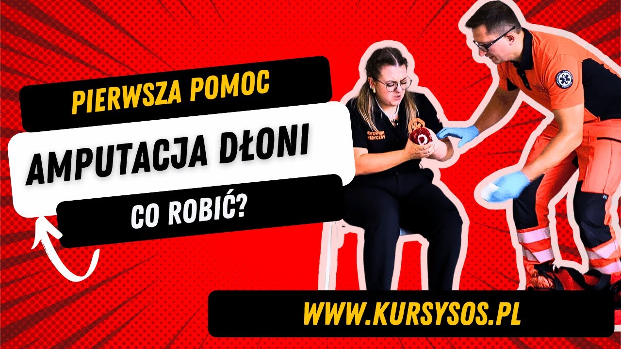 Amputacja dłoni #pierwszapomoc