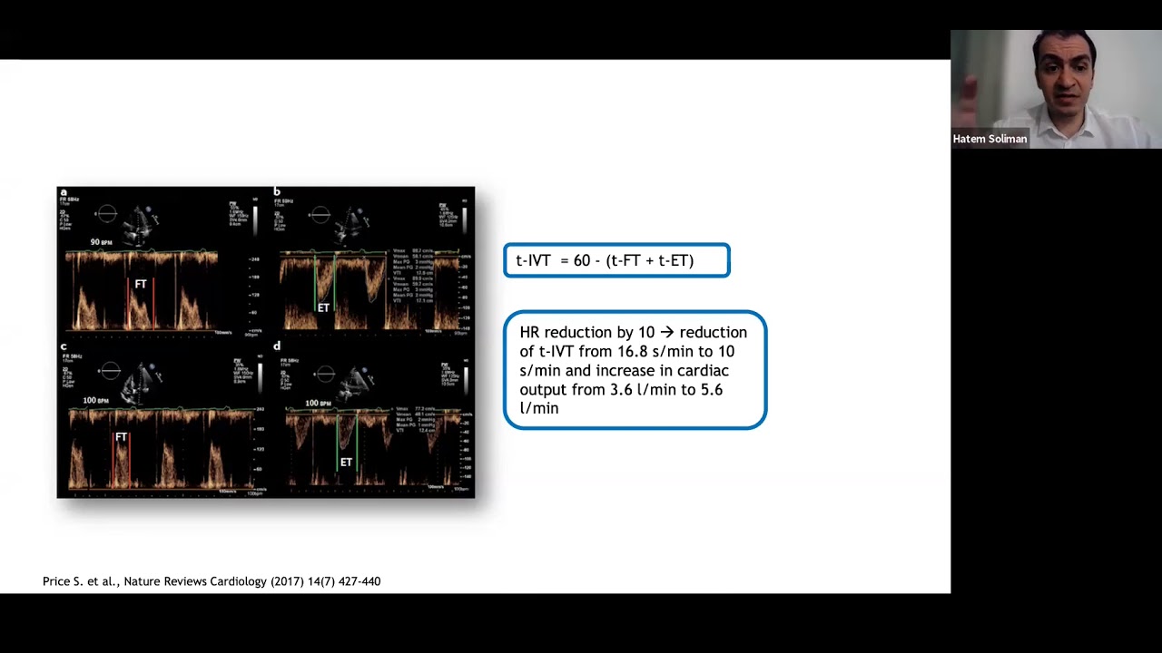 Advanced Echocardiography in shock - Dr. Hatem Soliman