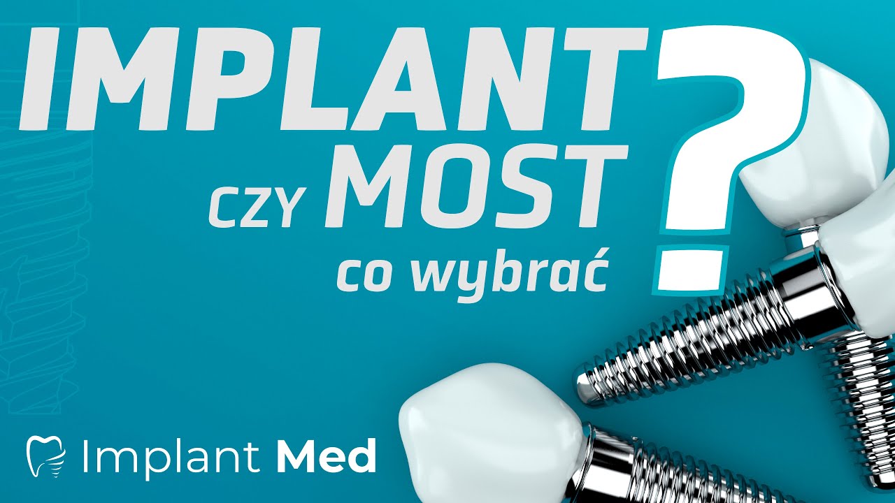 Implant czy most? Co wybrać?