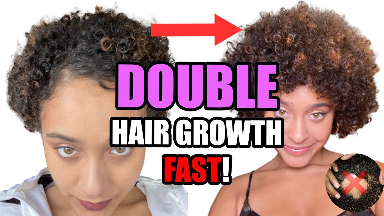 5 Powerful DHT BLOCKERS to regrow your thin hair.