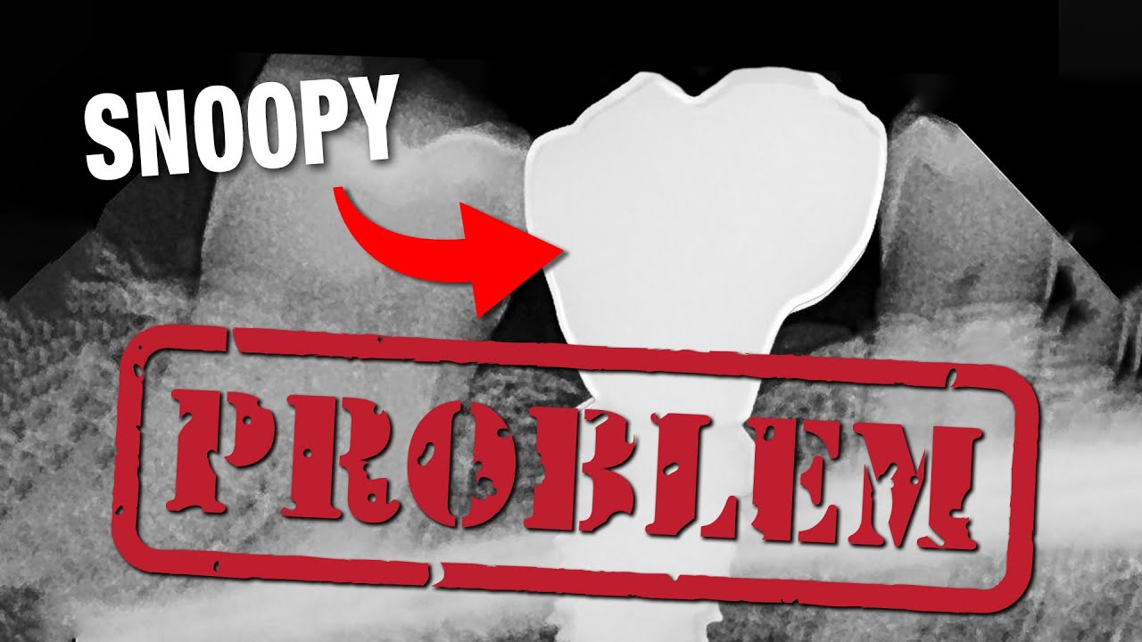 This MISTAKE makes your implants 7X more likely to FAIL
