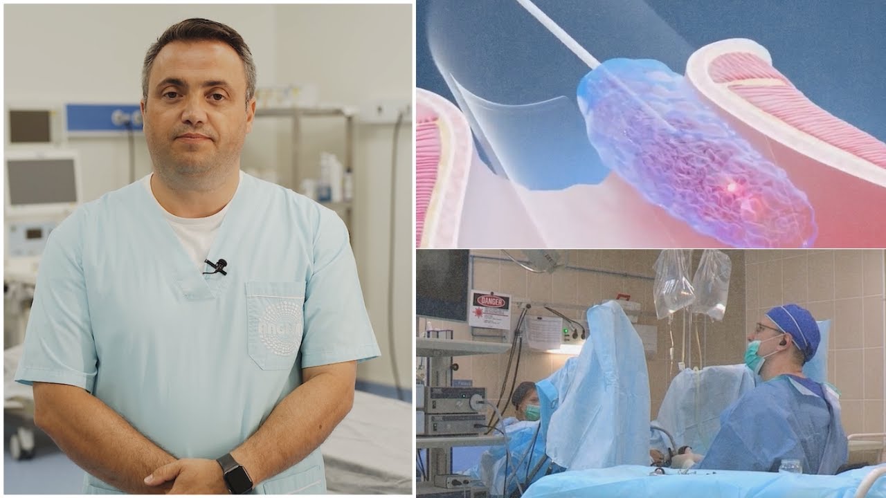 Tratamentul hemoroizilor cu laser - Hemoroidoplastie laser (LHP) - Dr. Dedu Răzvan, Clinica Angi San