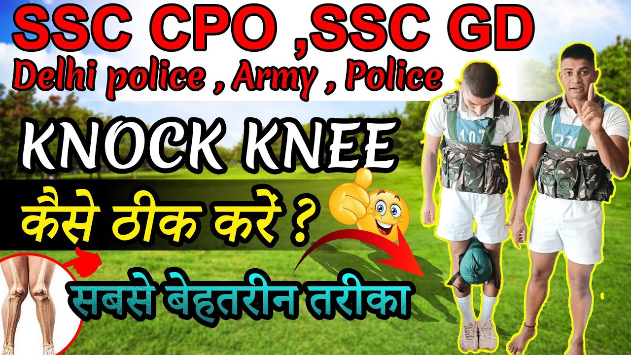 MEDICAL के लिए KNOCK KNEE केसे ठीक करें💯✨🎉🔥 for SSC CPO,SSC GD DELHI POLICE ,POLICE MEDICAL#SSCGD
