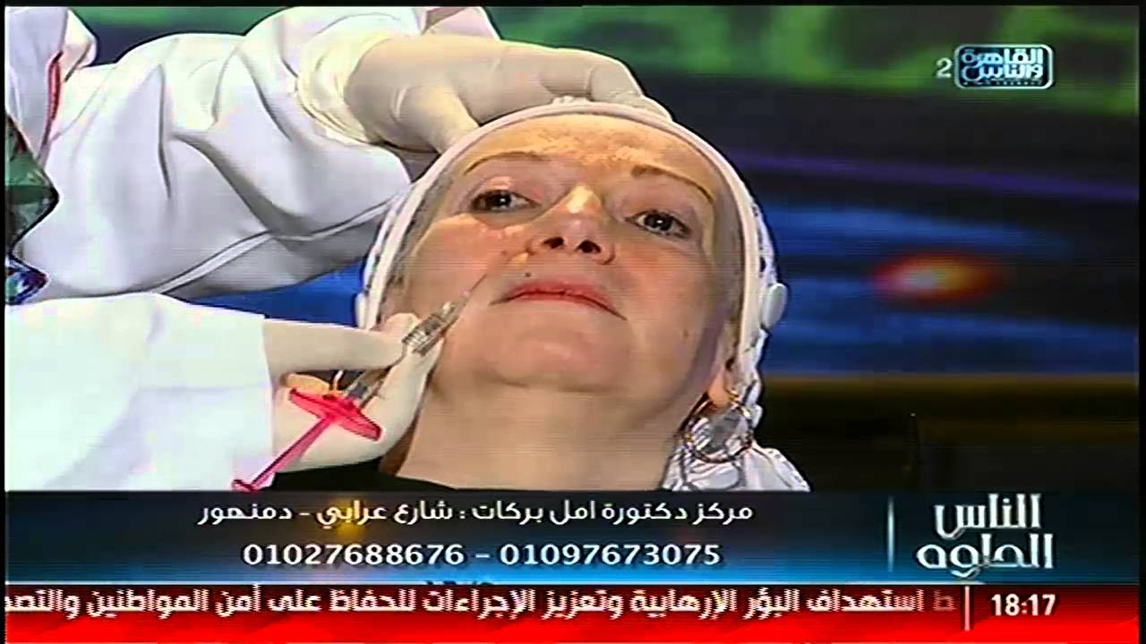 لأول مرة فى #الناس_الحلوة حقن الوجه وإخفاء التجاعيد على الهواء مع د/ أمل بركات  الجزء الاول