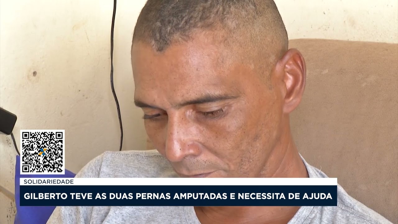 SOLIDARIEDADE: GILBERTO TEVE AS DUAS PERNAS AMPUTADAS E NECESSITA DE AJUDA