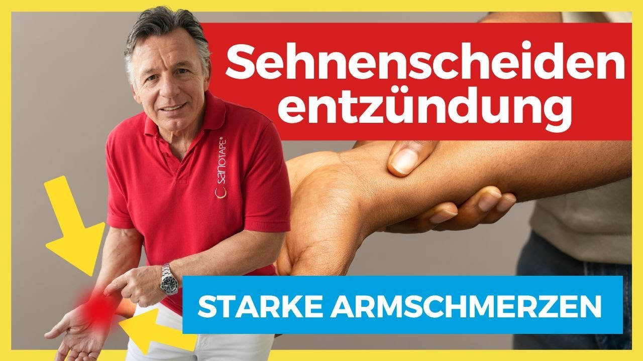 Starke Armschmerzen ⚡️ Sehnenscheidenentz&uuml;ndung - Verliere keine Zeit! Mach DAS!