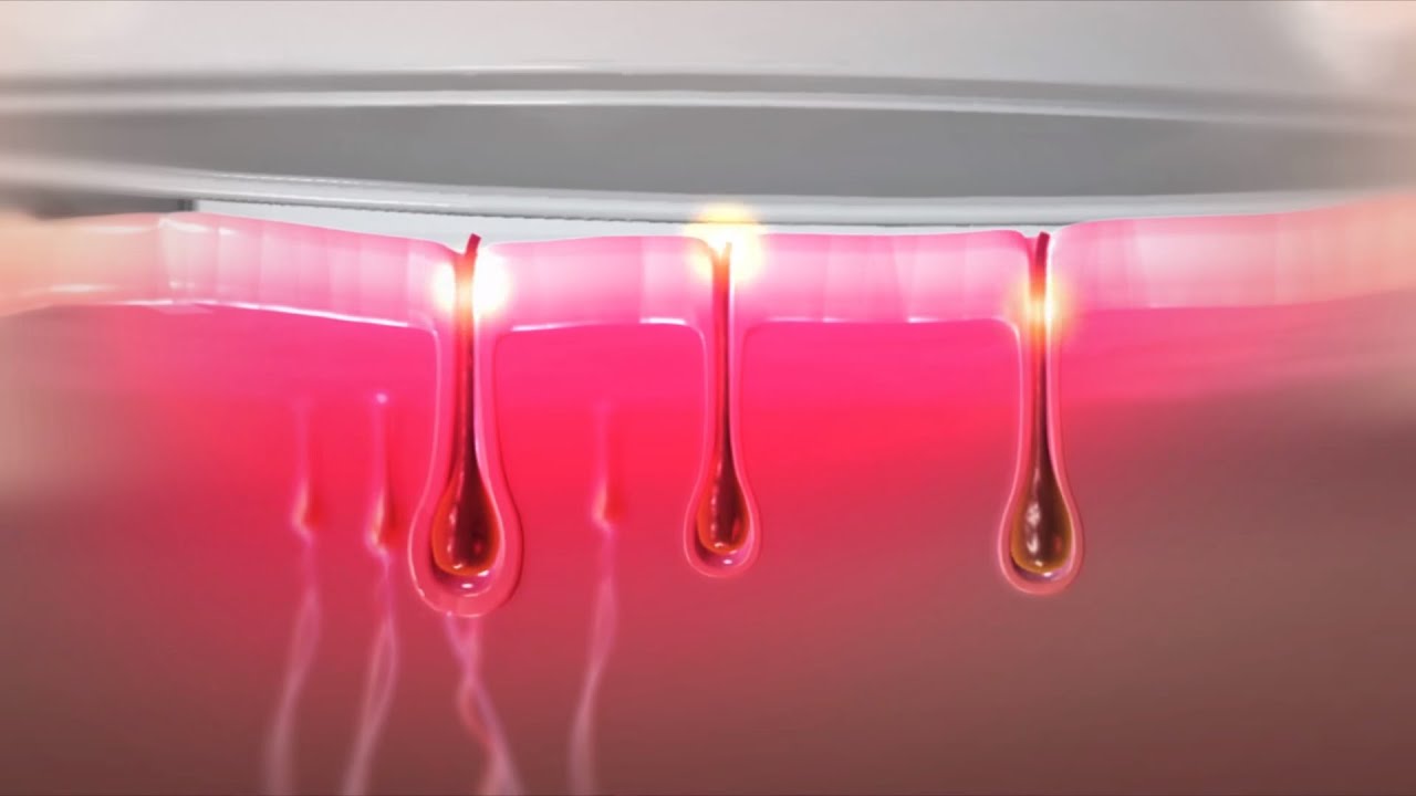 How does HPL™ technology from Silk'n work?