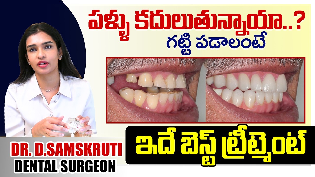 పళ్ళు కదులుతున్నాయా..? గట్టి పడాలంటే ఇదే బెస్ట్ ట్రీట్మెంట్ #teethtreatment #idreamhealthtalks