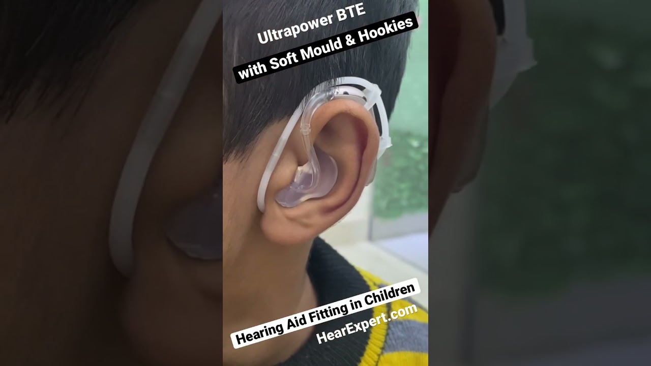 Hearing aid fitting in Children with BTE Soft mould and Hookies holder for Severe Hearing loss ||