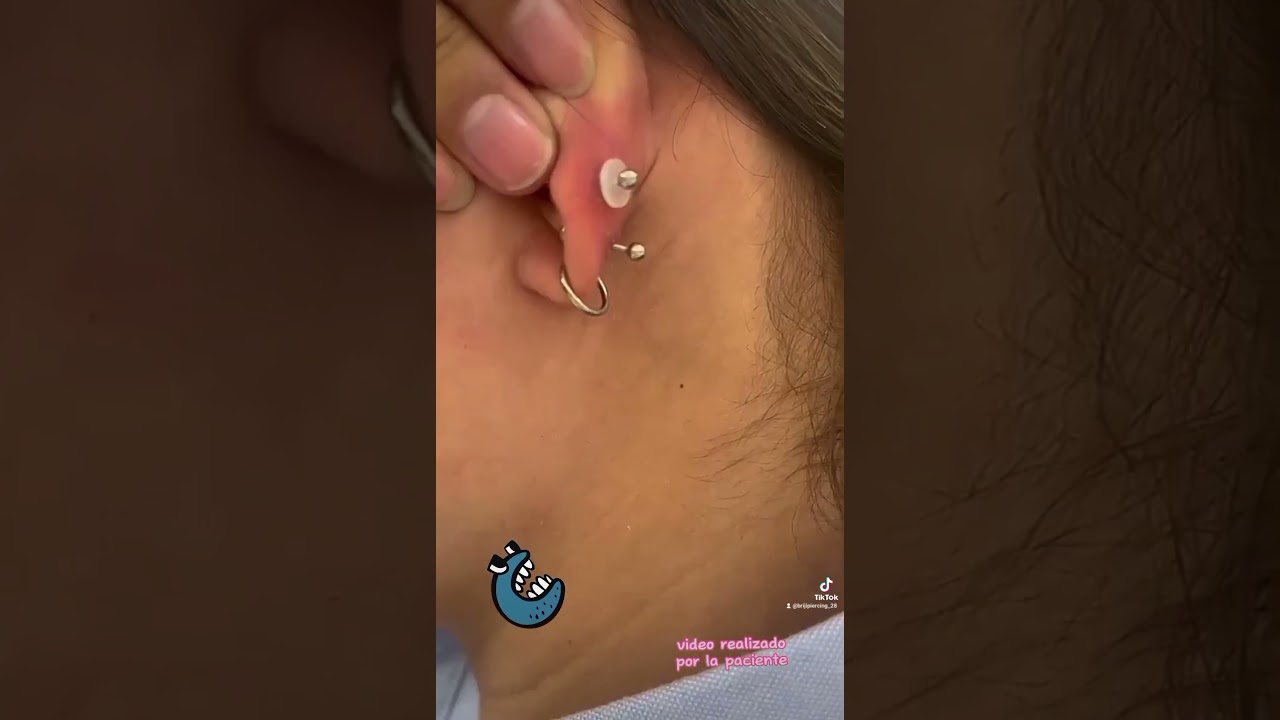 por.que no sana mi piercing