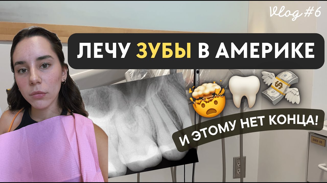 Лечение зубов в Америке - удаление нерва, цены, стоит ли? | USA Vlog #6