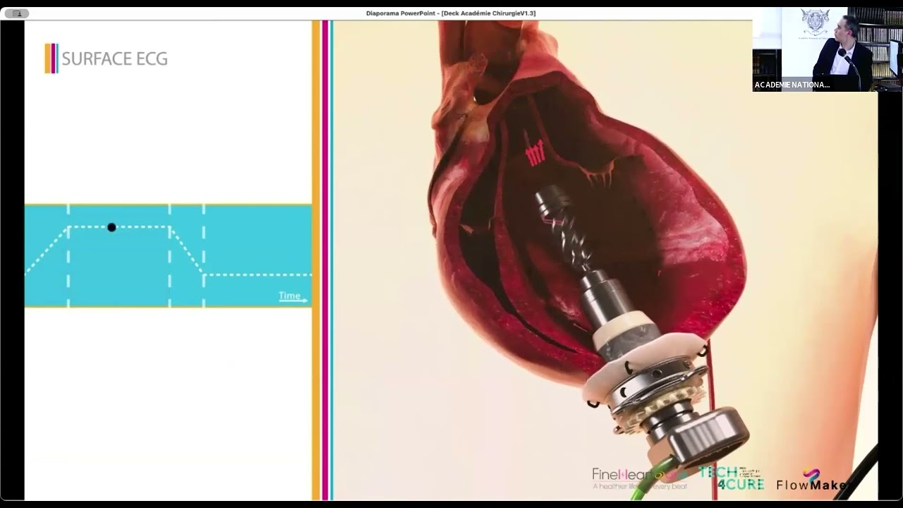 05 Flowmaker® Chirurgie 4.0