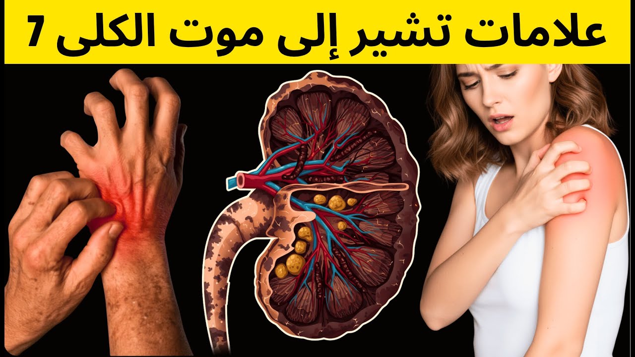 ٥. سر لا يخبرك به الأطباء عن أعراض فشل الكلى الخفية
