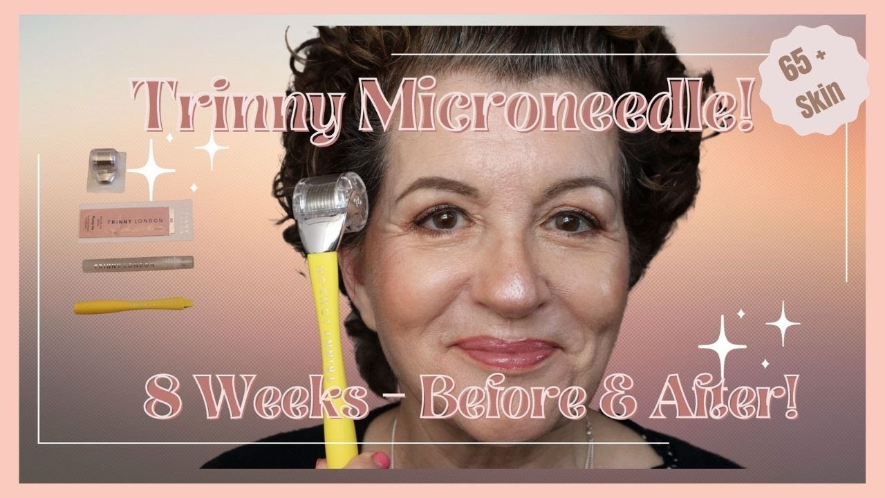 TRINNY MICRONEEDLE // 8 Week Review!