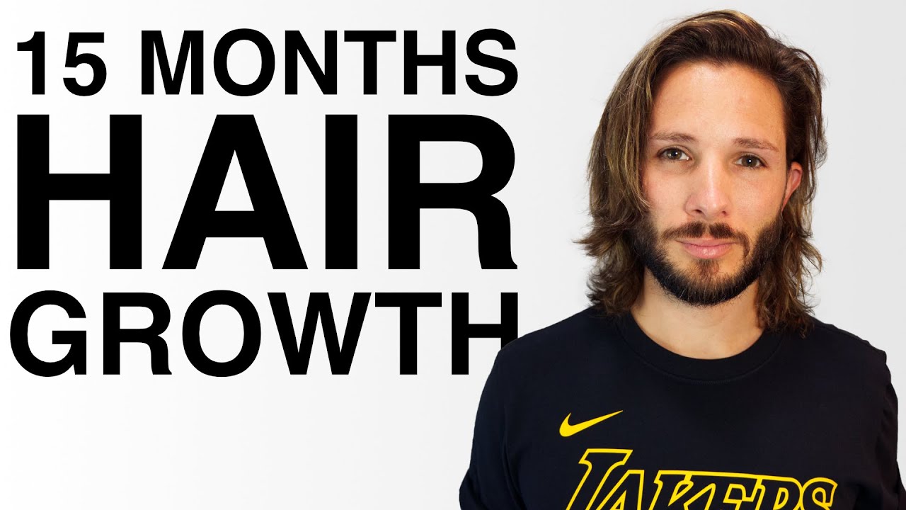 15 Months Hair Growth | Men's Hair Growth Journey