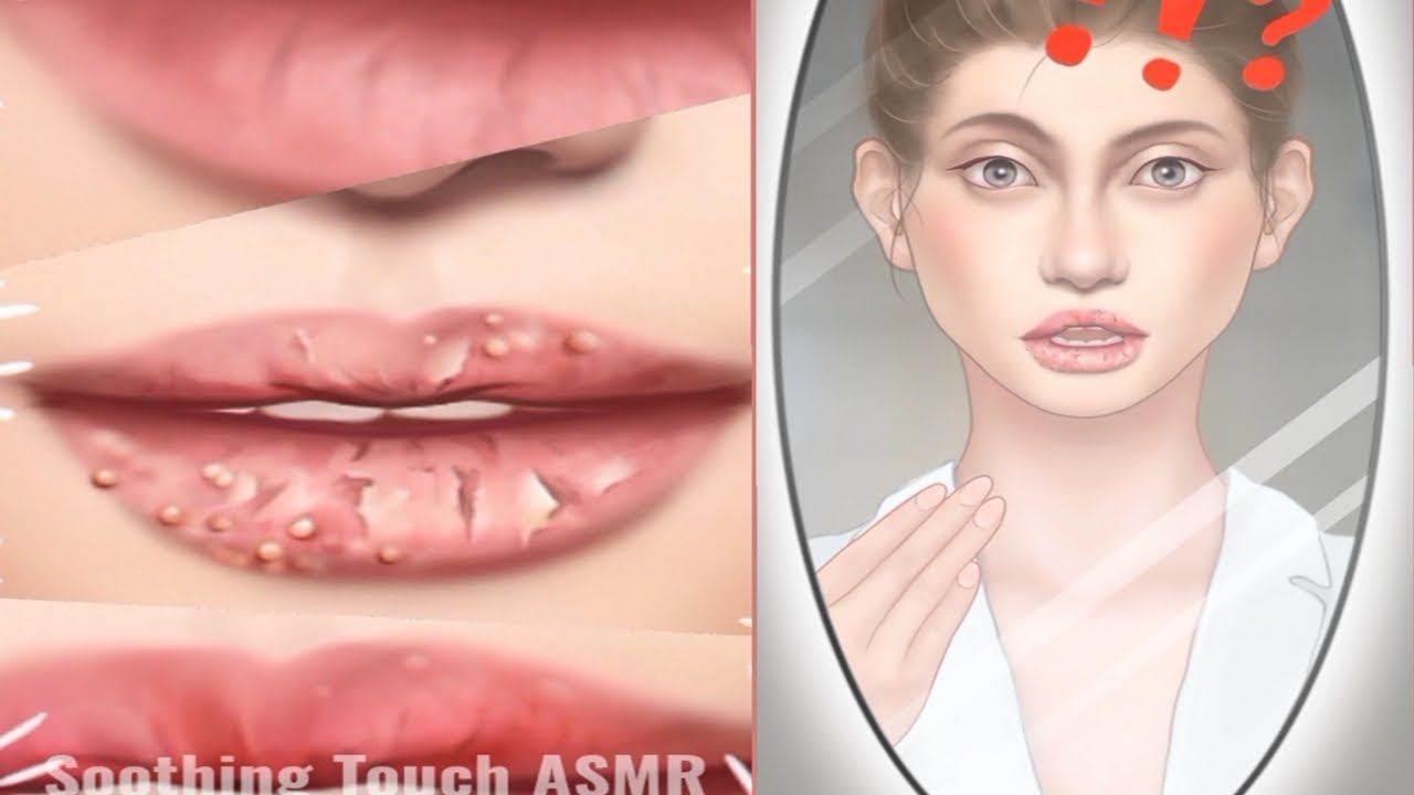 Asmr swollen lips treatment | Swollen Lips animation video | Soothing Touch ASMR