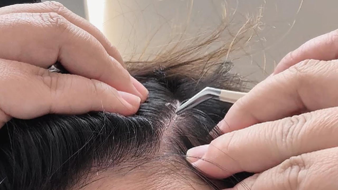 ASMR Soothing Dandruff Scraping with Tweezer, Comb & Nails – No Talking
