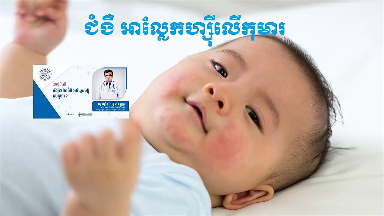 Allergic Reaction - ជំងឺ អាល្លែកហ្ស៊ីលើកុមារ by Dr. អៀង វណ្ណៈ