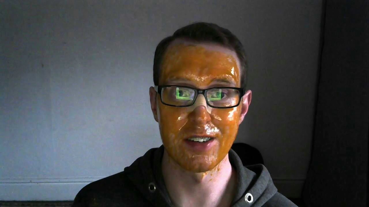 Will azelaic acid help Mirvaso-induced redness? Plus: a turmeric honey face mask & a rant about a GP
