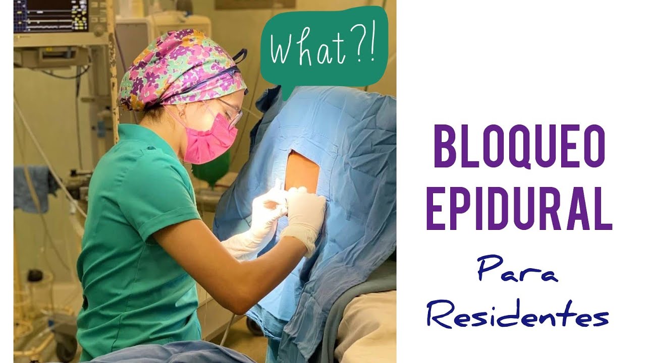 Bloqueo Epidural, técnica y anatomía para Residentes