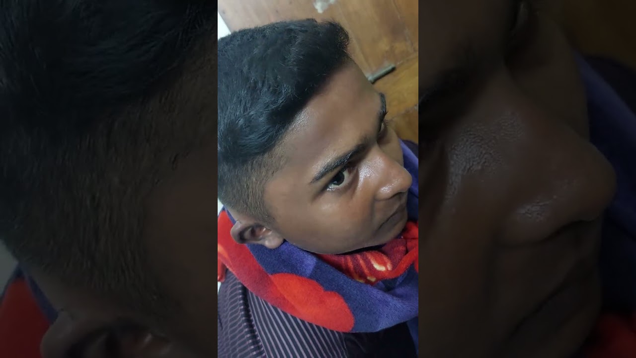 Post Auricular Abscess