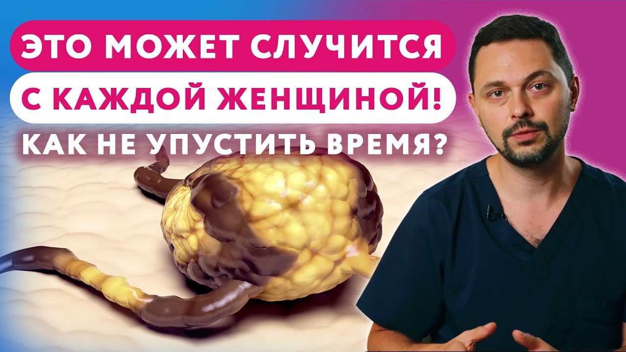 Удаление или наблюдение? Узлы молочной железы #клиникащербатовой #маммолог  #узлымолочнойжелезы