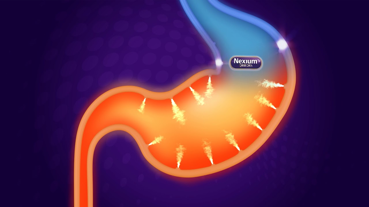 Nexium 24HR | Is Frequent Heartburn Interrupting Your Sleep?