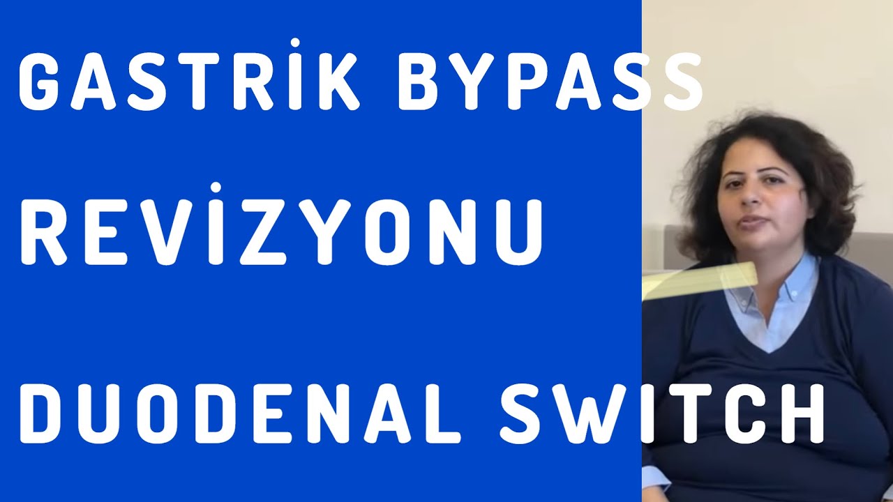 BAŞARISIZ GASTRİK BYPASS’ın DUODENAL SWITCH ‘e REVİZYONU