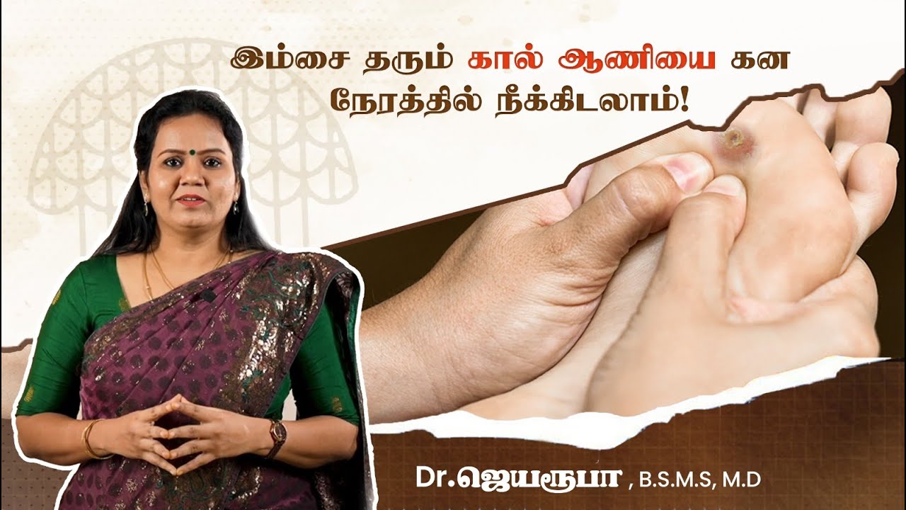 இம்சை தரும் கால் ஆணியை கன நேரத்தில் நீக்கிடலாம்!Dr. Jayaroopa