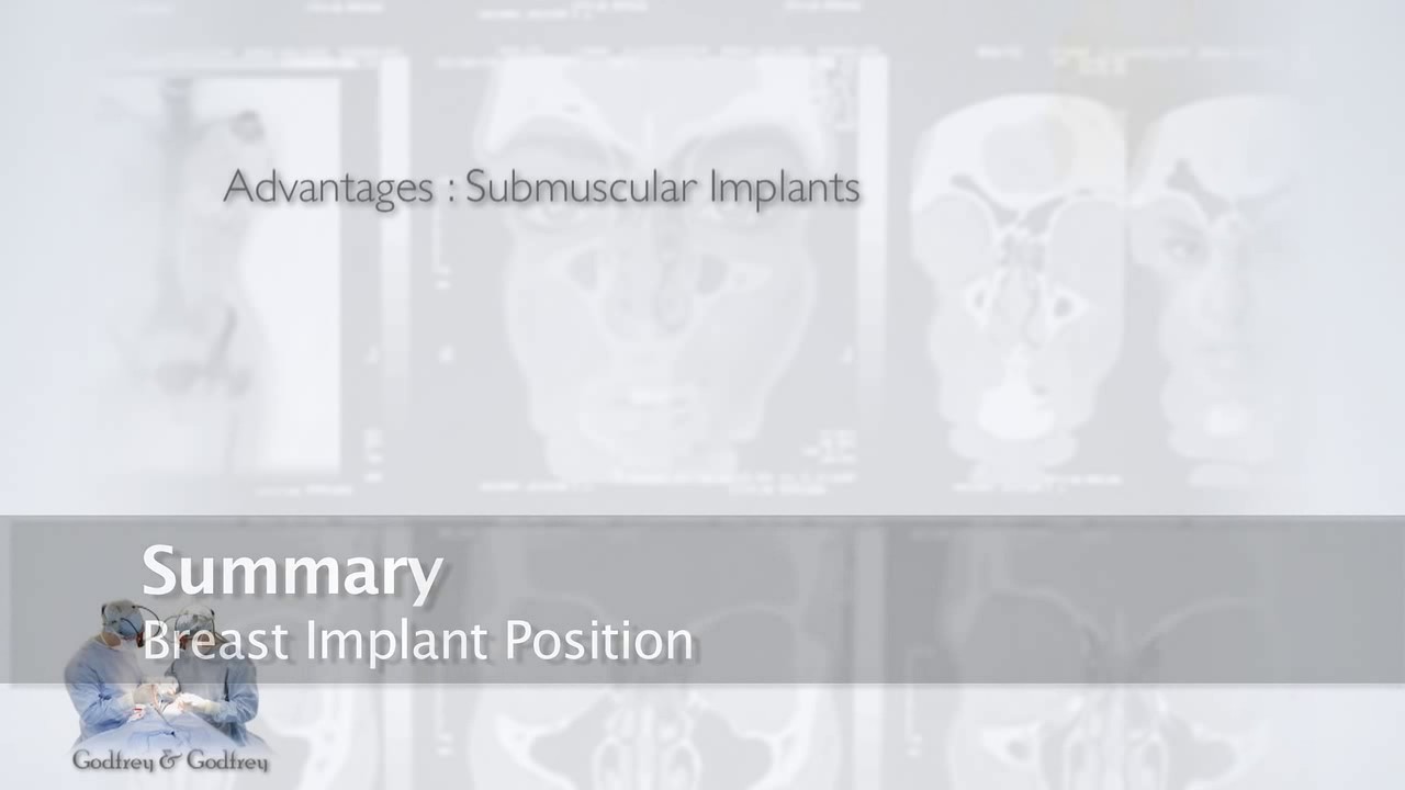 Breast Implants: Above Or Below Muscle?