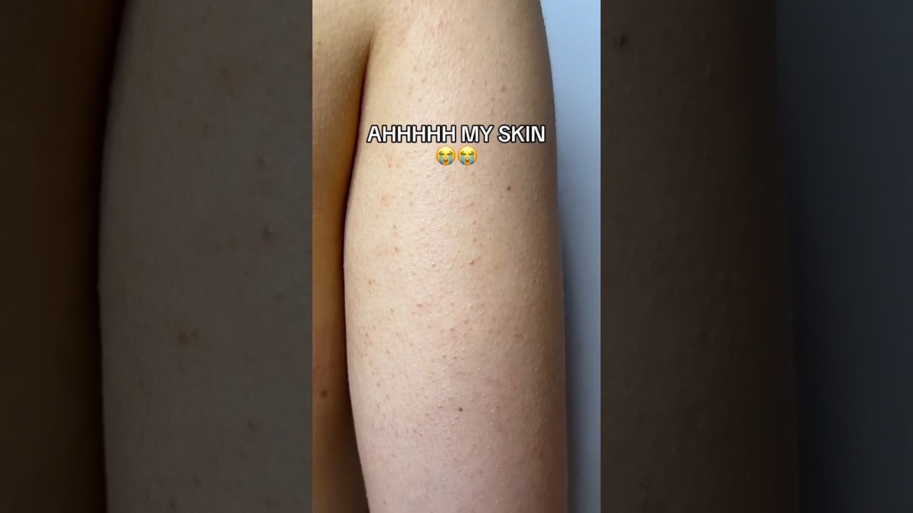 Home made Body scrub | How to remove strawberry legs ✨🦋 #shorts #ytshorts #aesthetic #fypシ゚viral