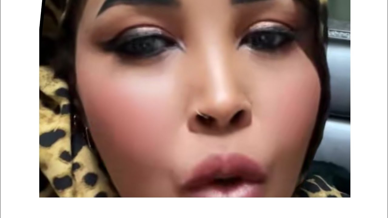 Istahiil iyo ayaan qurux dagalkoda maxa kala qabsaday ila dawo