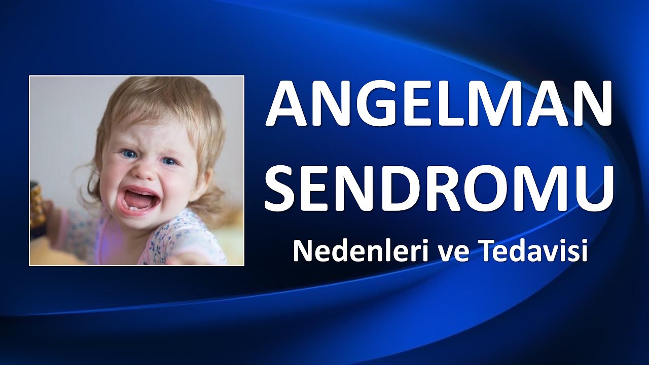ANGELMAN SENDROMU NEDENLERİ VE TEŞHİSİ