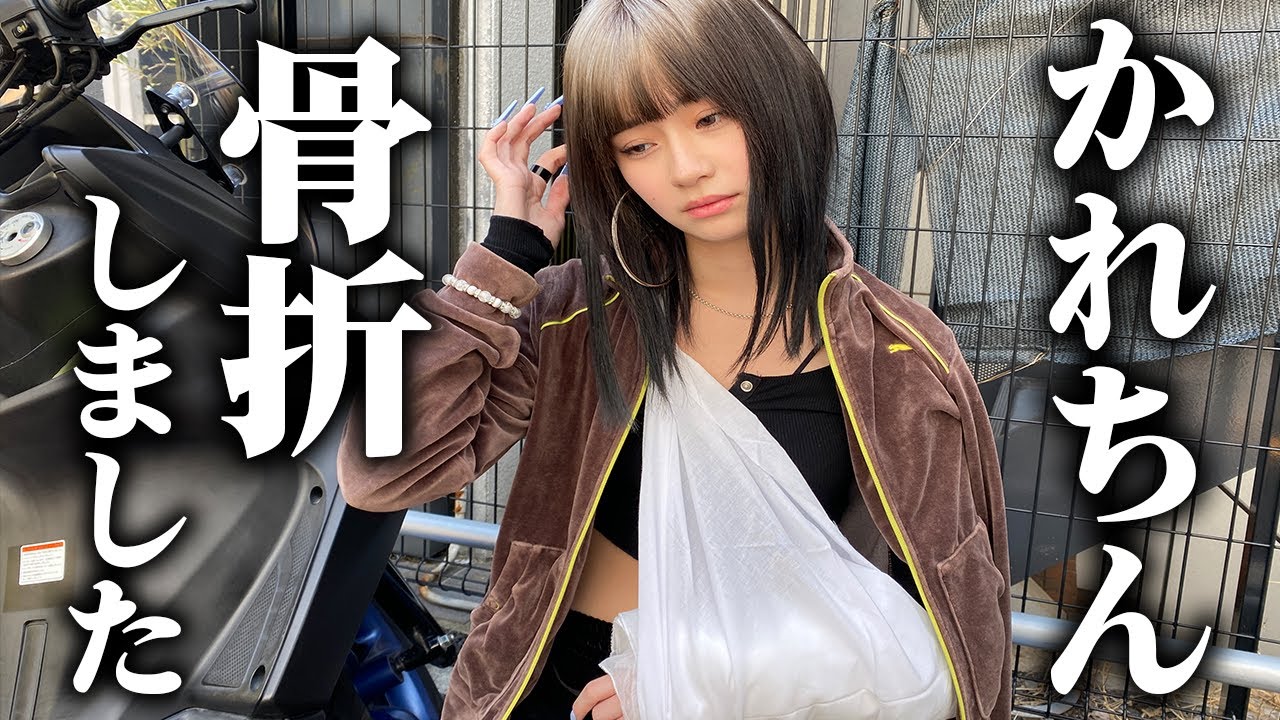 かれちんがバイク事故で骨折しました。【ドッキリ】